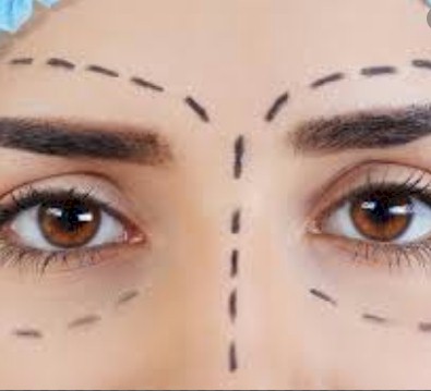 elevacion cejas
