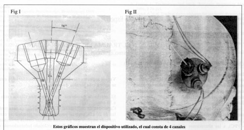 mioma cervical